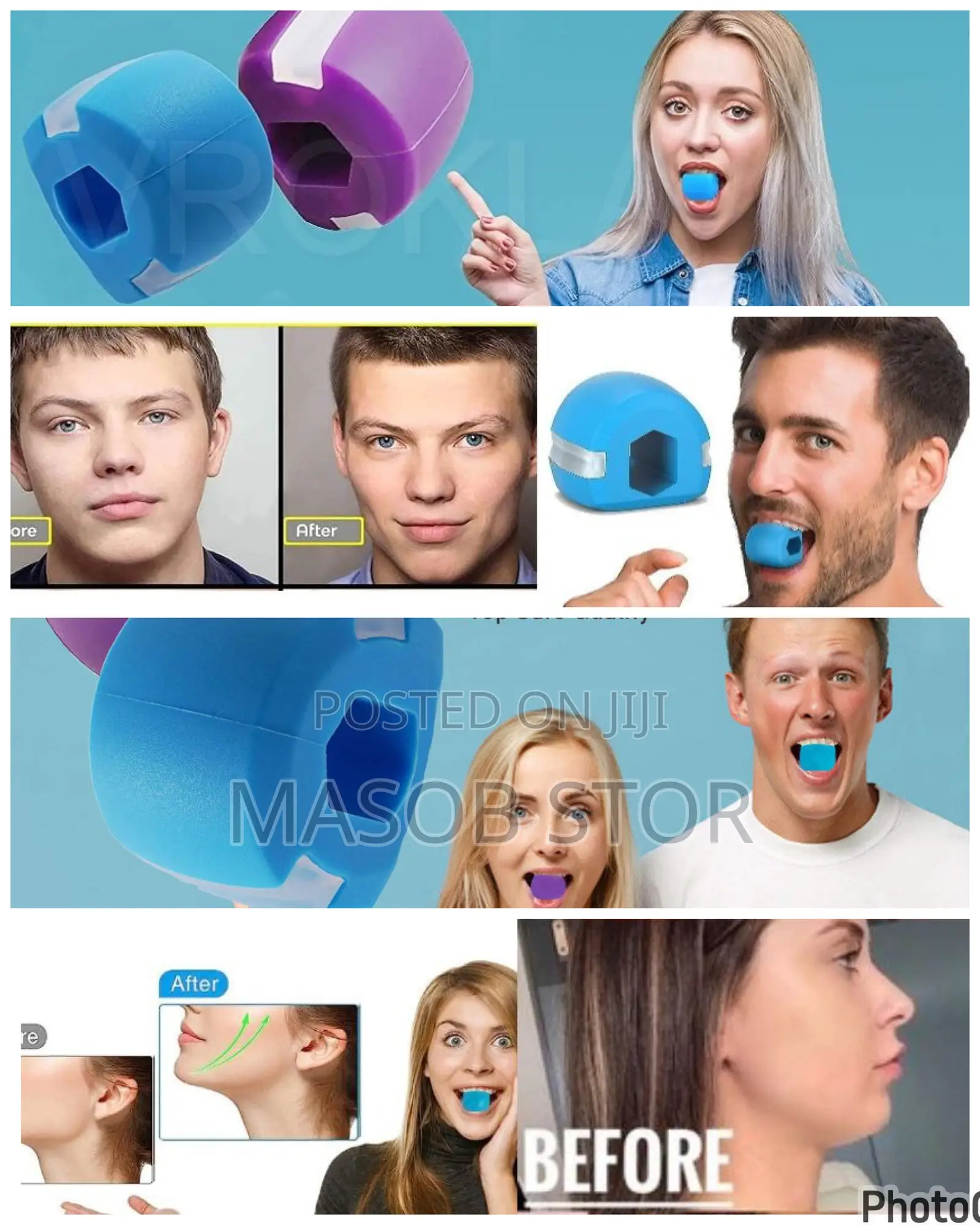 Jaw Liner / የአገጭ ስብ ማጥፊያ