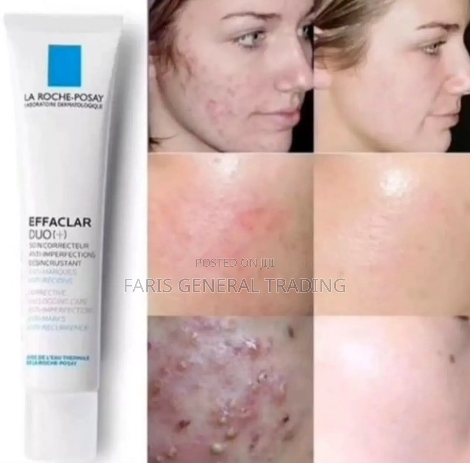 La Roche Duo Acne Remover