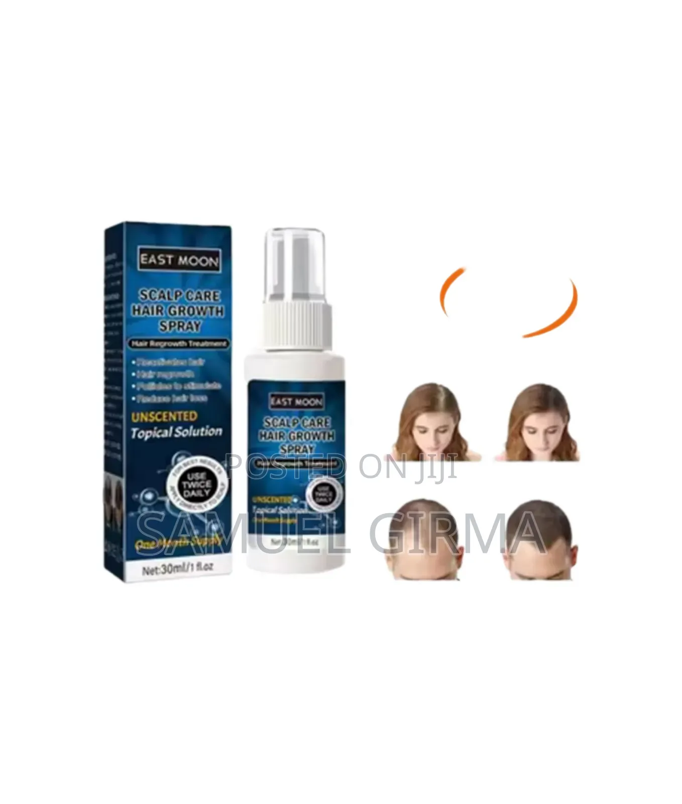 Eastmoon Hair Growth Spray ፀጉር ማሳደጊያ ቅባቶች