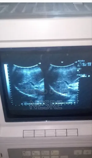 Photo -  Used Ultrasound Machine
 Brand: Aloka