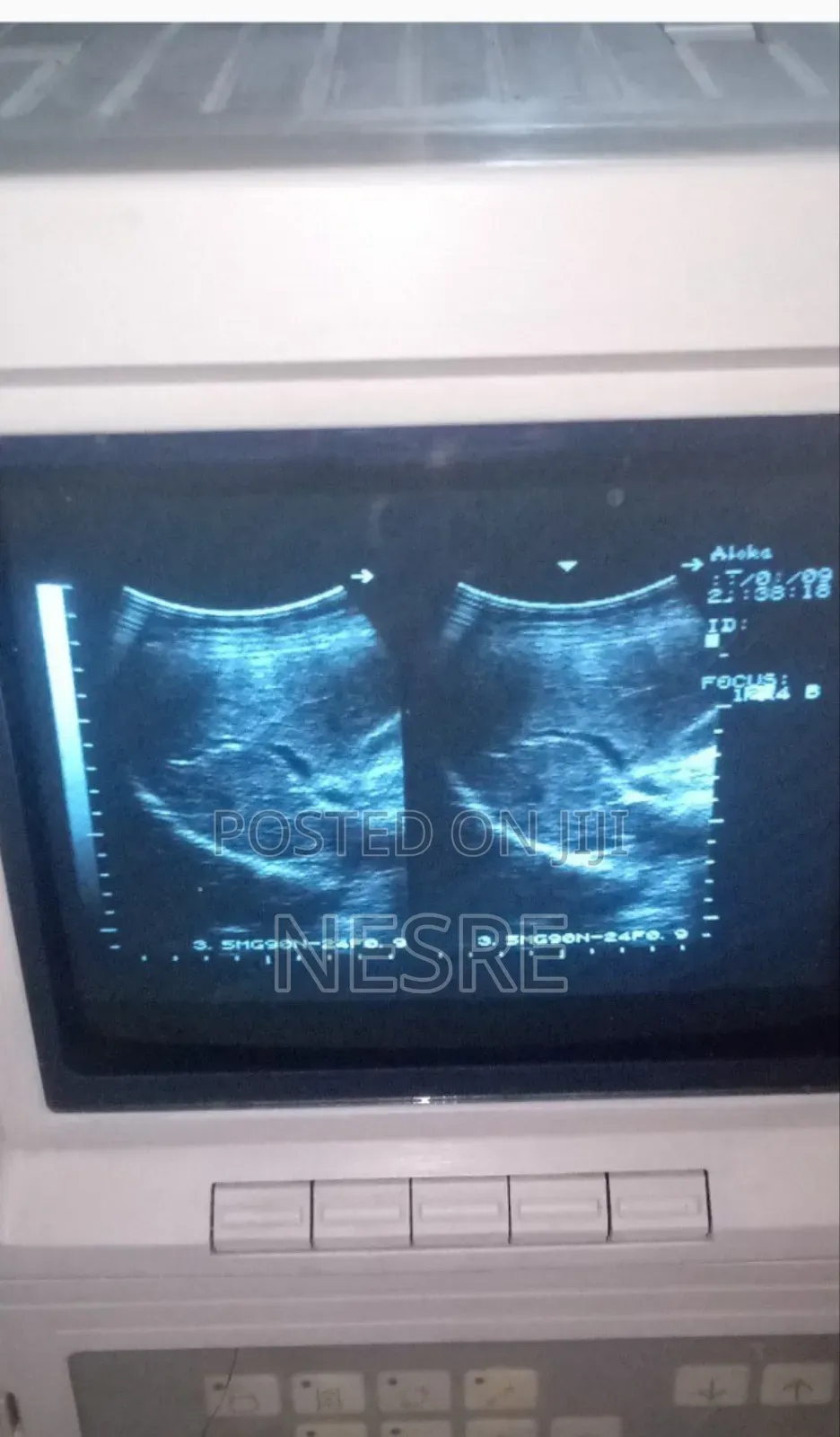  Used Ultrasound Machine
 Brand: Aloka