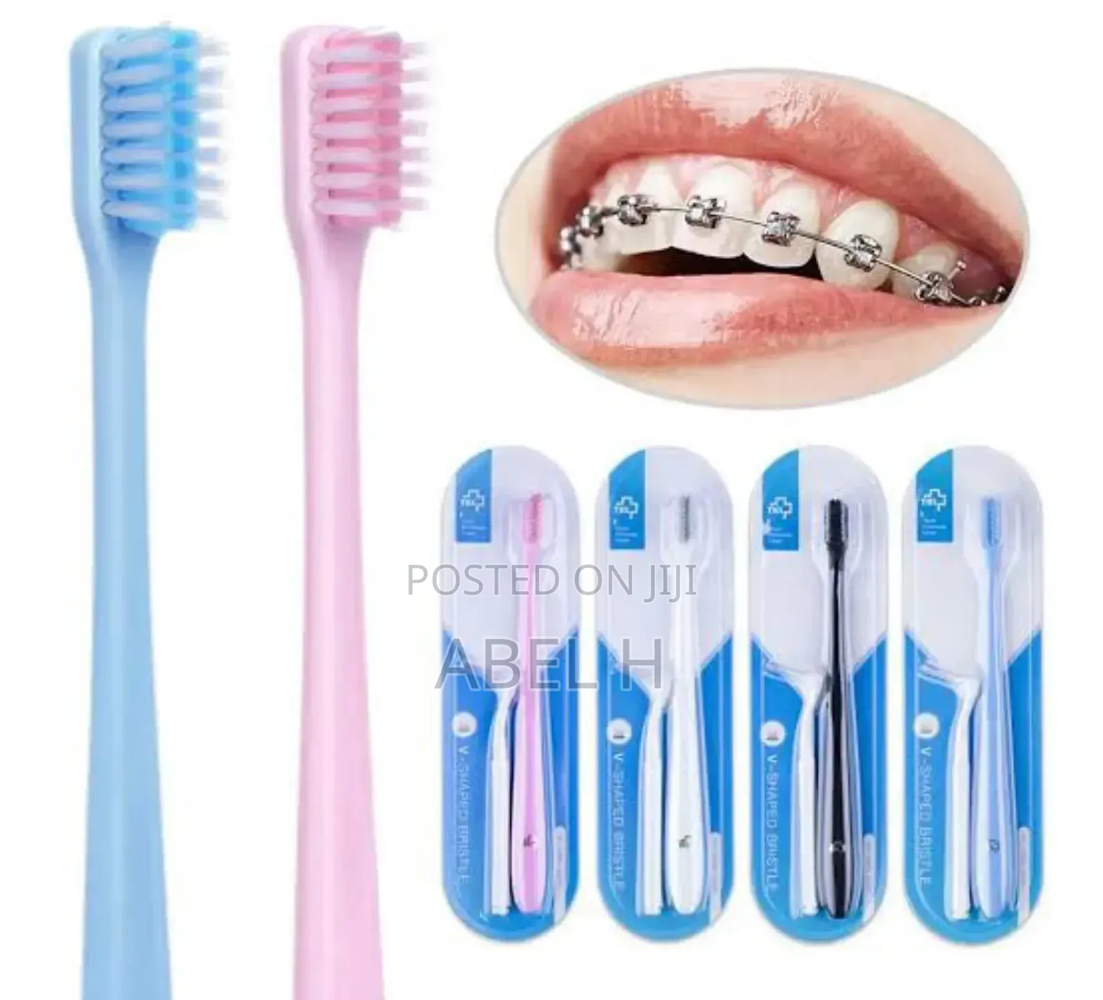 Y-Kelin v-Shaped Orthodontic Toothbrush for Braces