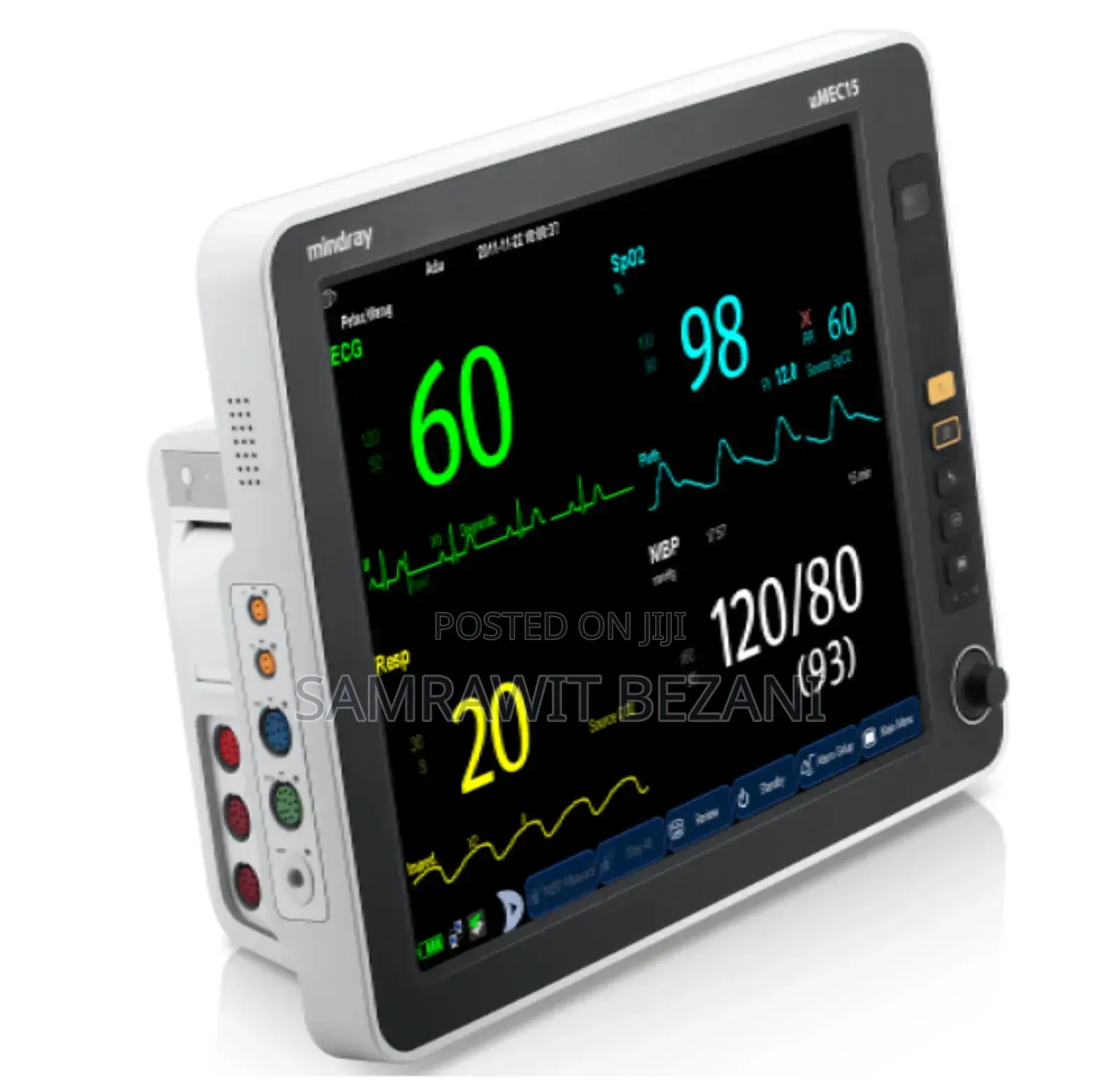 Mindray Patient Monitor
