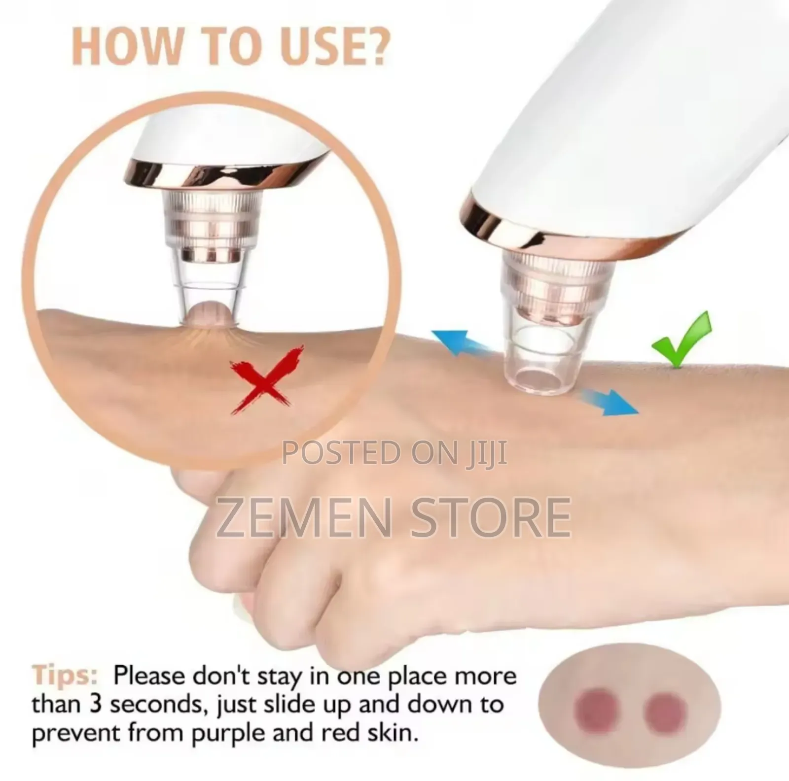 Blackheads Remover ፅድት ፍክት ያለ ፊት አንዲኖሮት