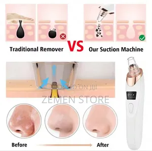 Blackheads Remover ፅድት ፍክት ያለ ፊት አንዲኖሮት