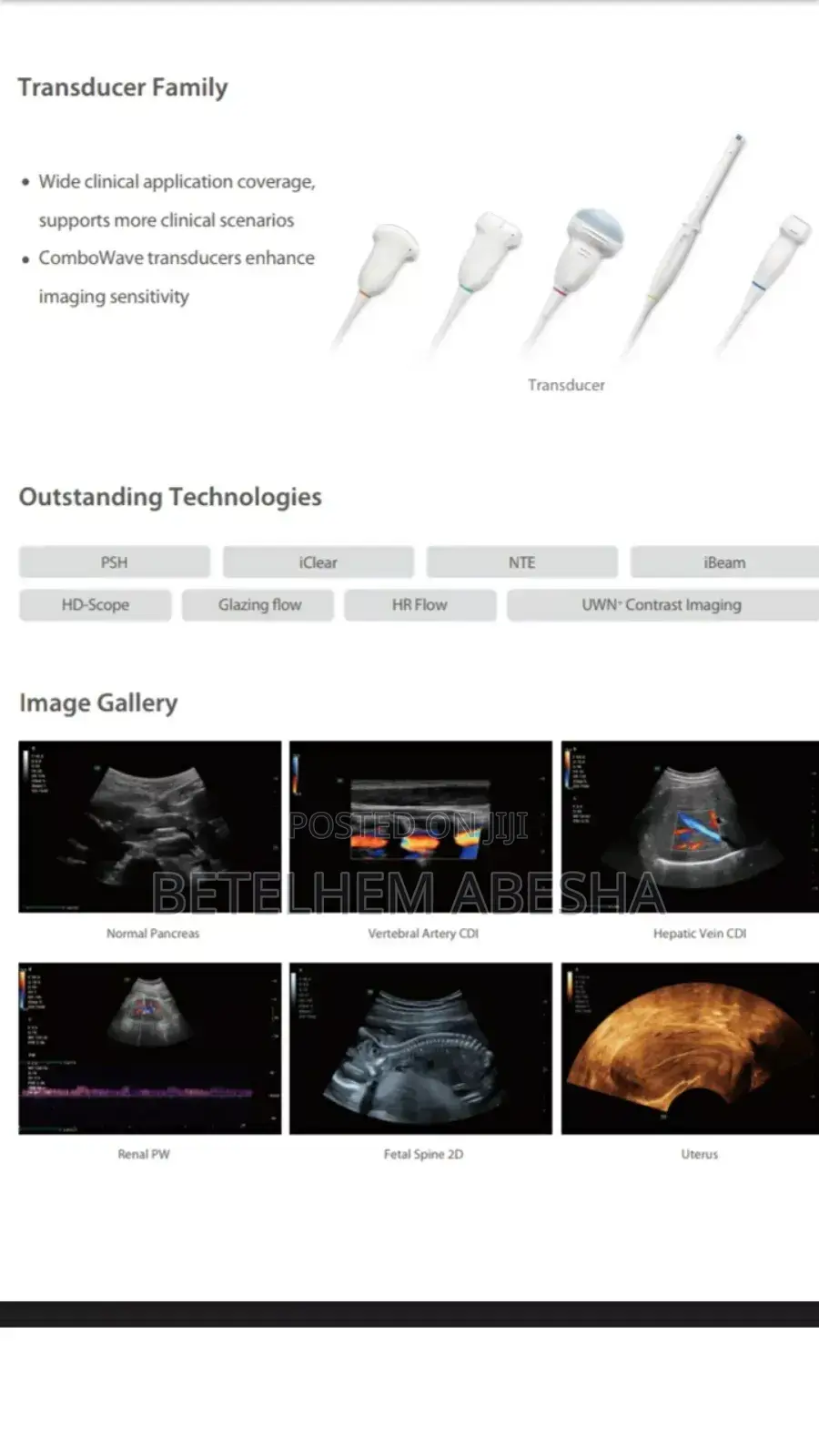 Ultrasound Consona N6t