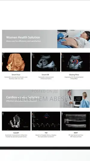 Ultrasound Consona N6t