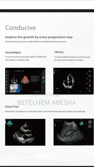 Ultrasound Consona N6t