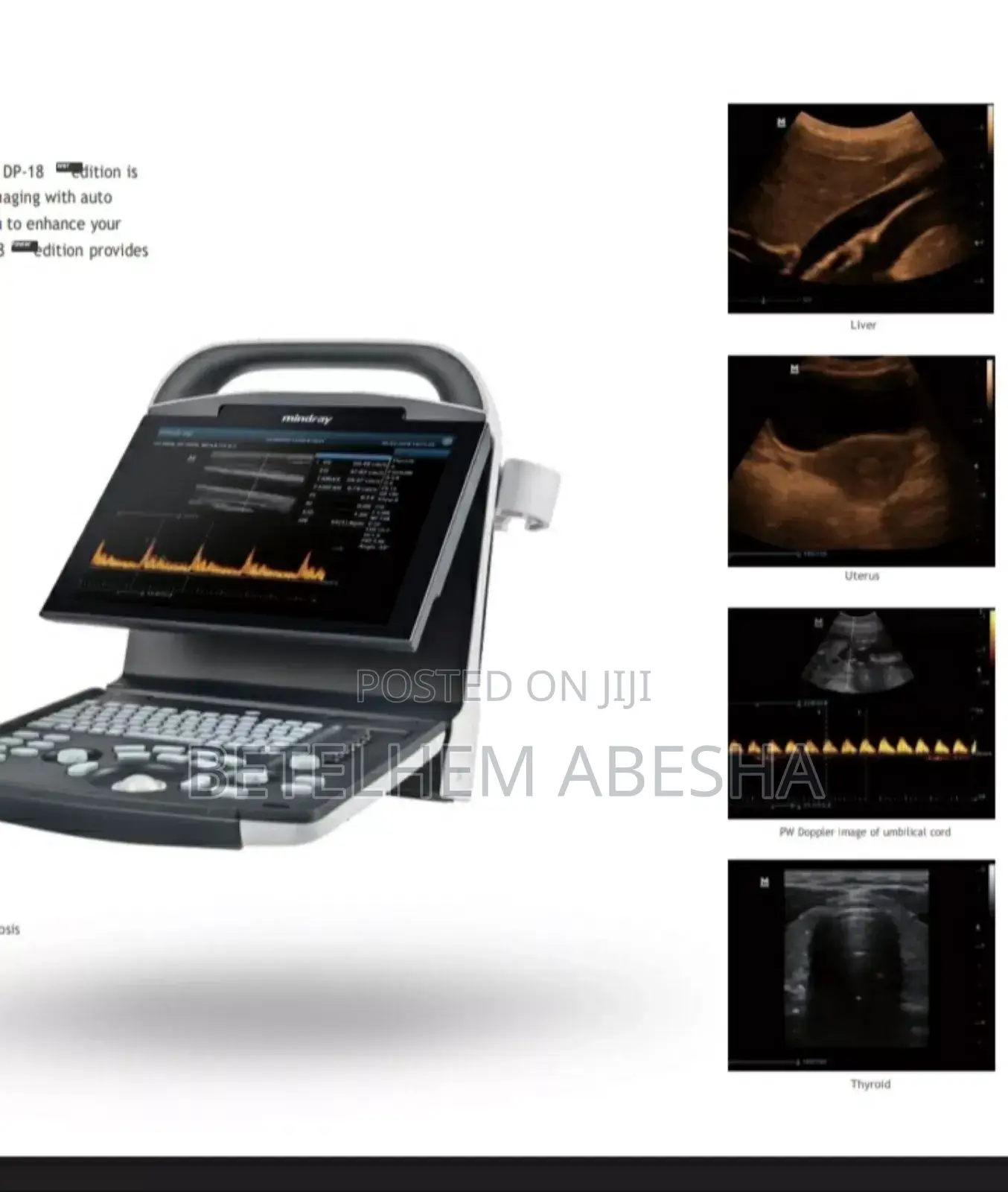 Ultrasound Dp-18