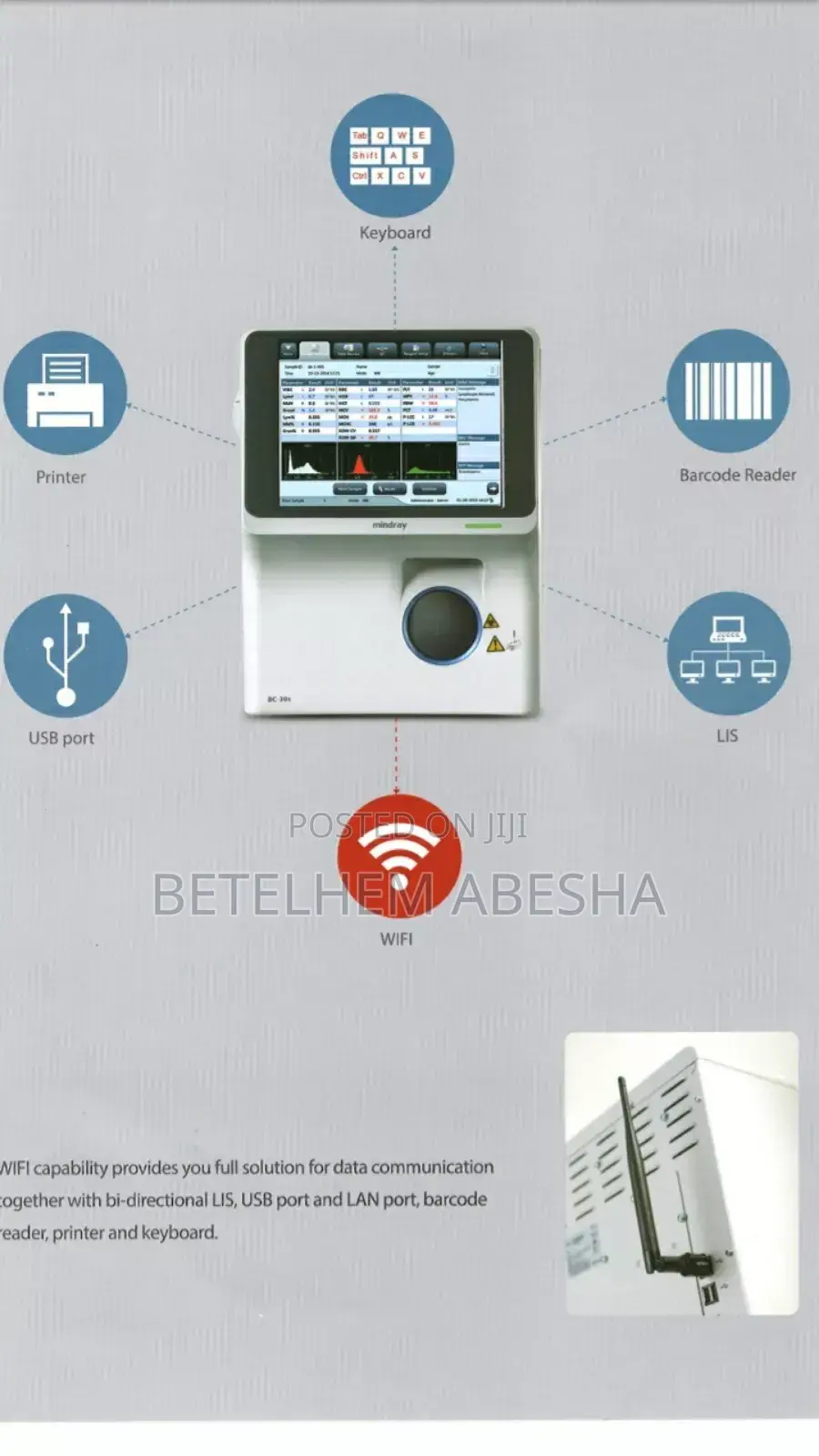 Cbc(Hematology Analyzer)