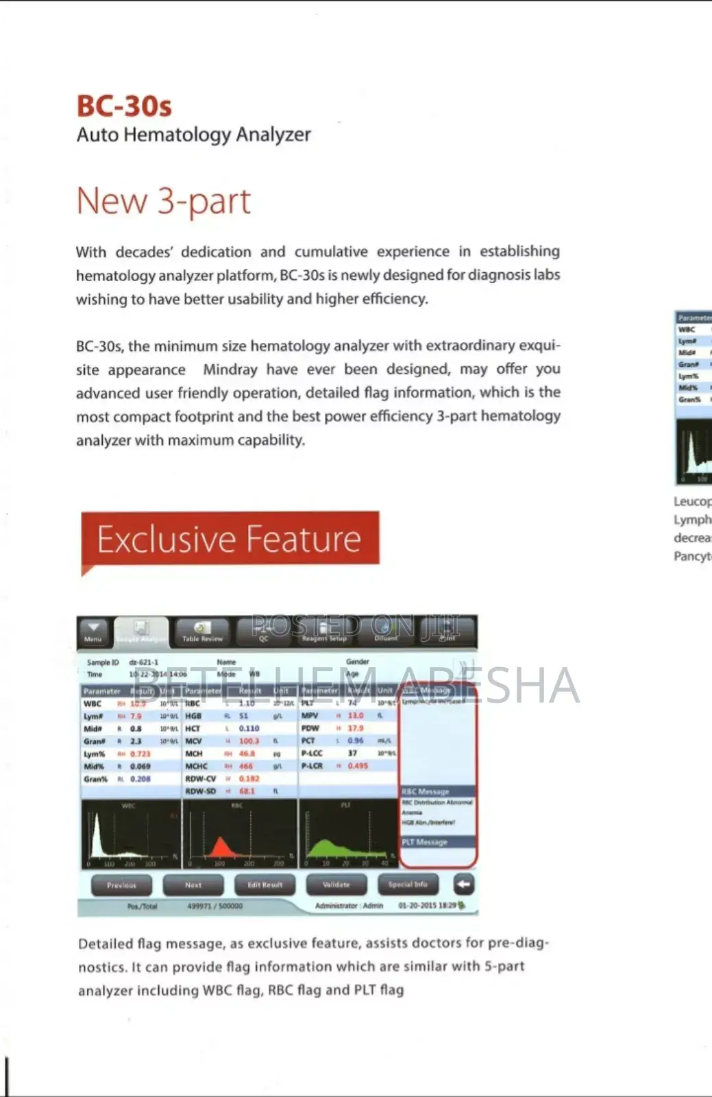 Cbc(Hematology Analyzer)