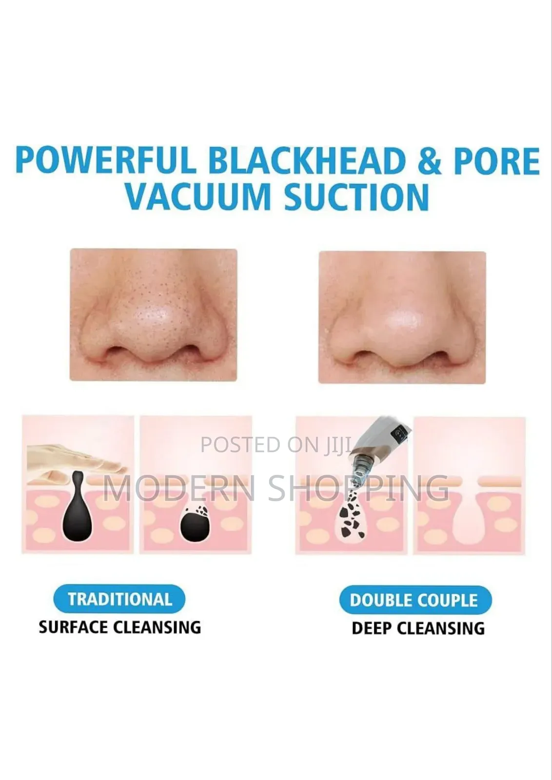 Multifunctional Blackhead Remover for Clear Skin