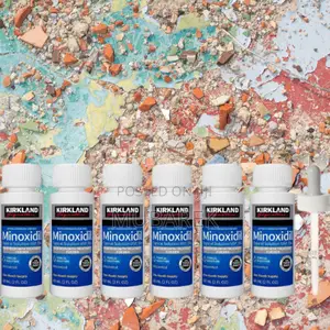 Photo - Minoxidil for Bald Men's Hair Loss