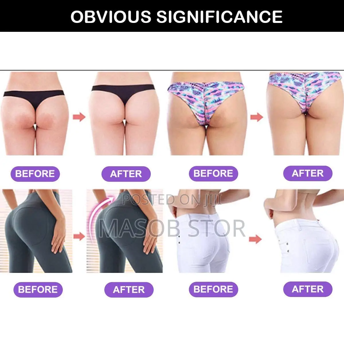 የዳሌዎ ወይም የመቀመጫ ማሳደጊያ /?Dr-rashel Hip Lift