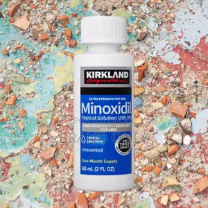 Photo - Minoxidil for Bald Spots Treatment Now