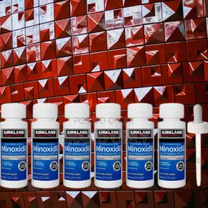 Photo - Minoxidil for Bald Men's Hair Help