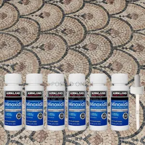 Photo - Minoxidil Best for Afro Hair: Healthy Scalp Conditions