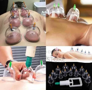 Traditional Cupping Terapy