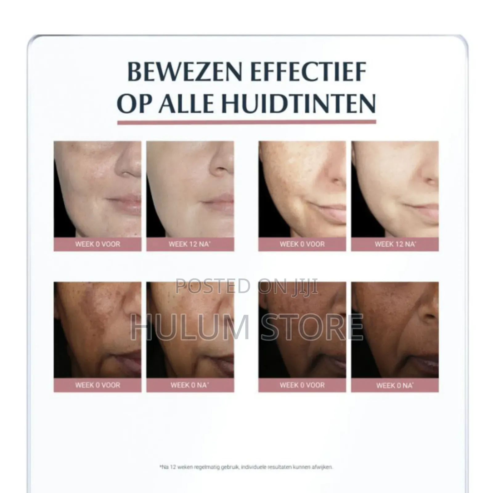 Eucerin Anti-Pigment Dual Serum