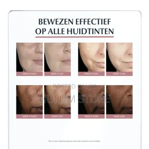 Eucerin Anti-Pigment Dual Serum