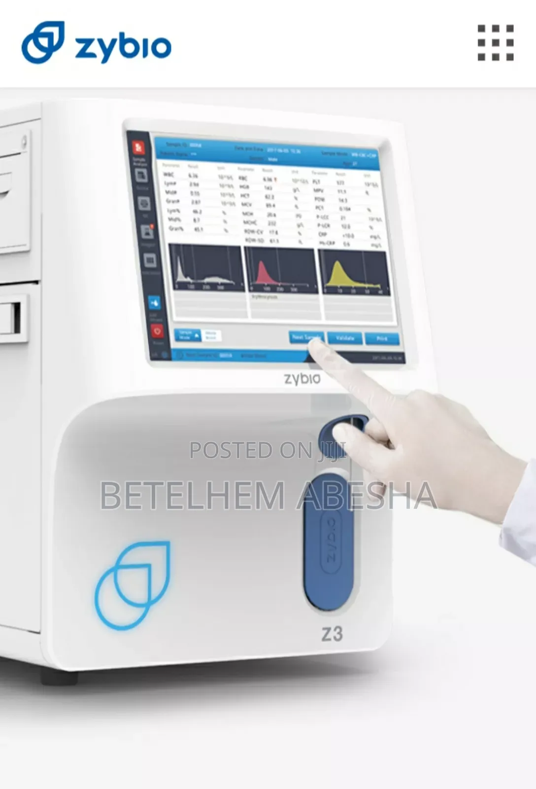 Cbc(Hamatology Analayzer)