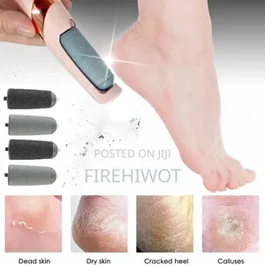 Photo - Calluses Remover