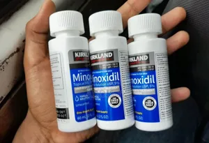 Photo - "Kirkland Minoxidil: Clinically Proven for Hair Restoration