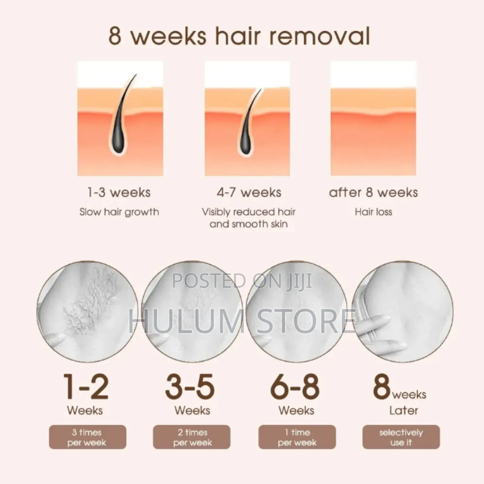 Ipl Hair Removal Device