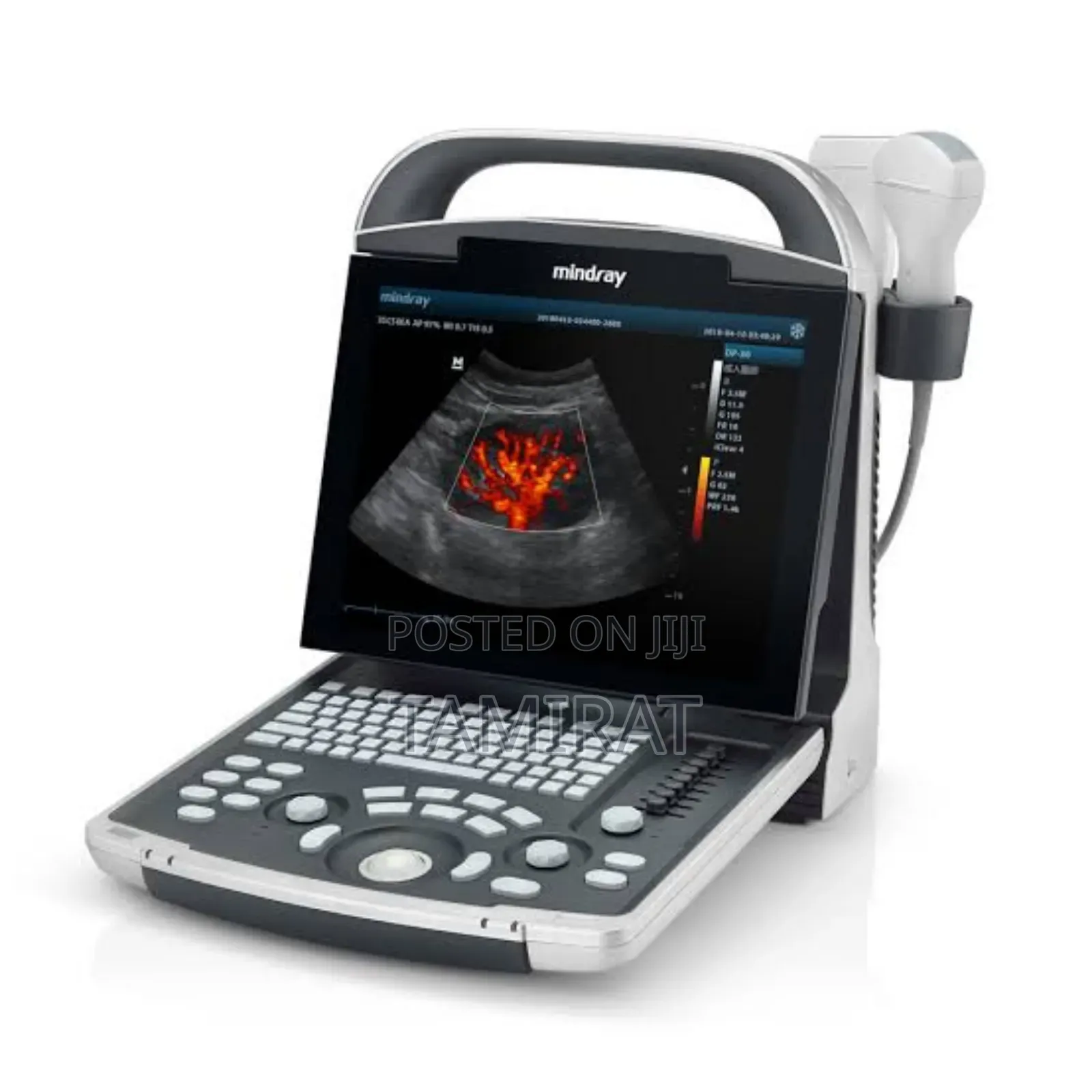 Mindray Ultrasound