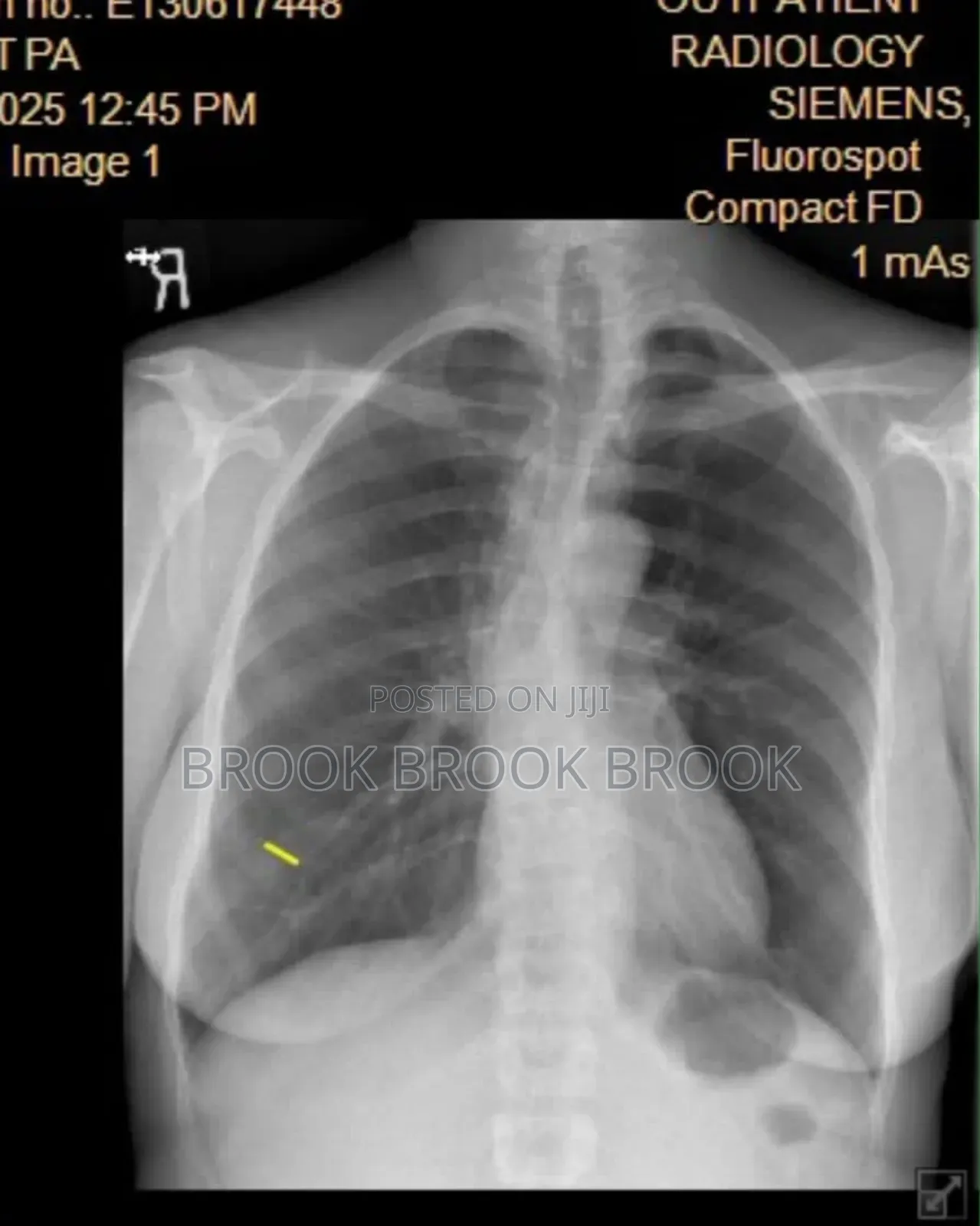 ለ ወገብ ጀርባ እንዲሁም የ ጉልበት እና እግር ህክምና (Traditional Chiropracto
