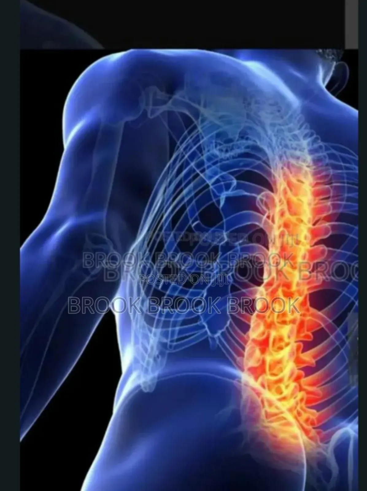 ለ ወገብ ጀርባ እንዲሁም የ ጉልበት እና እግር ህክምና (Traditional Chiropracto