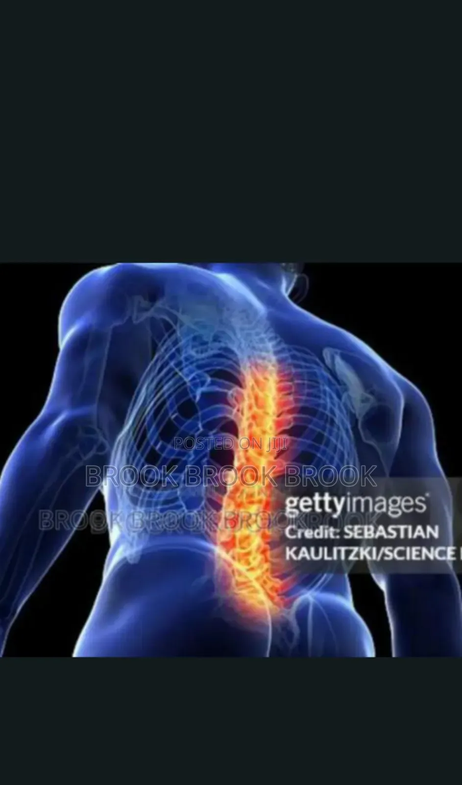 ለ ወገብ ጀርባ እንዲሁም የ ጉልበት እና እግር ህክምና (Traditional Chiropracto