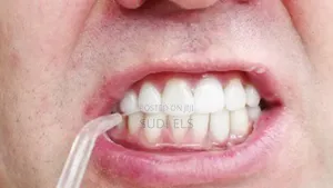 Photo - Oral Irrator