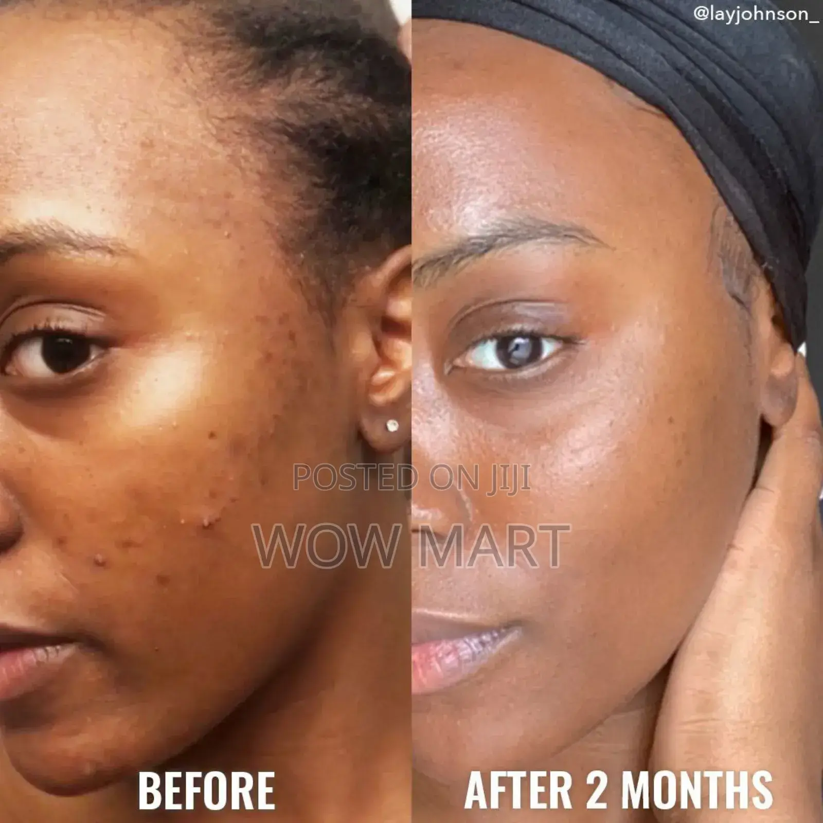 Good Molecules Discoloration Correcting Serum -