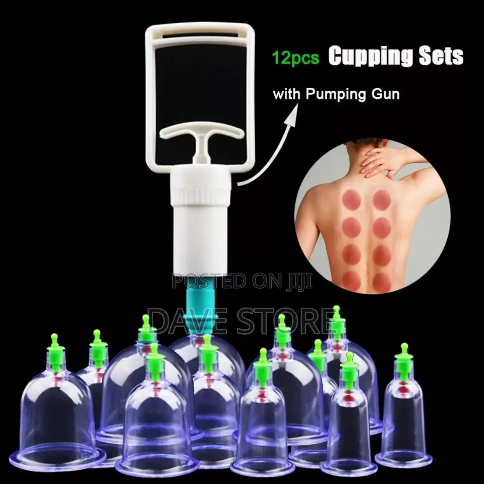 Suction Cupping