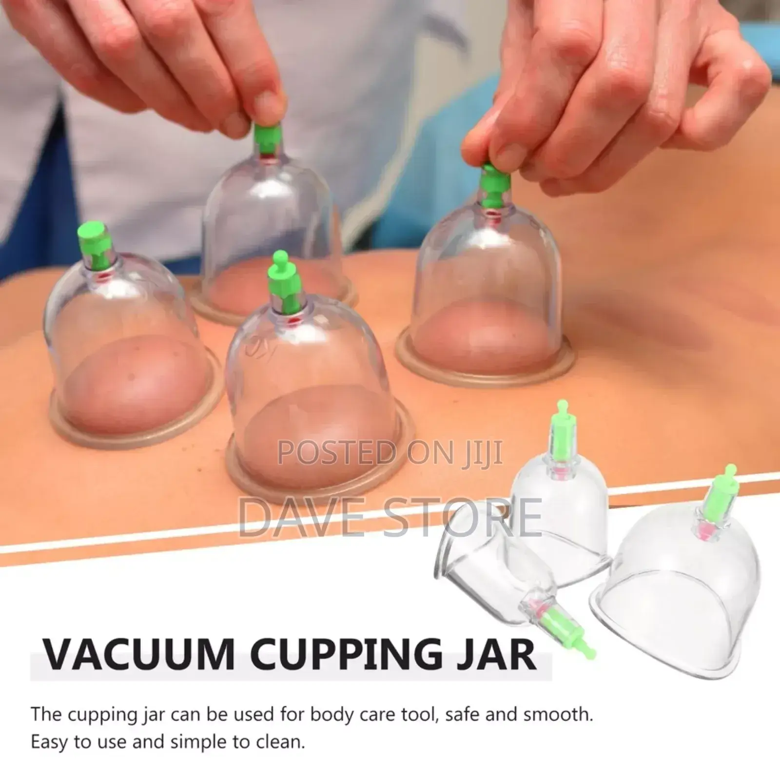 Suction Cupping