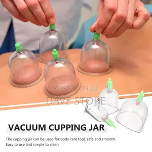 Suction Cupping