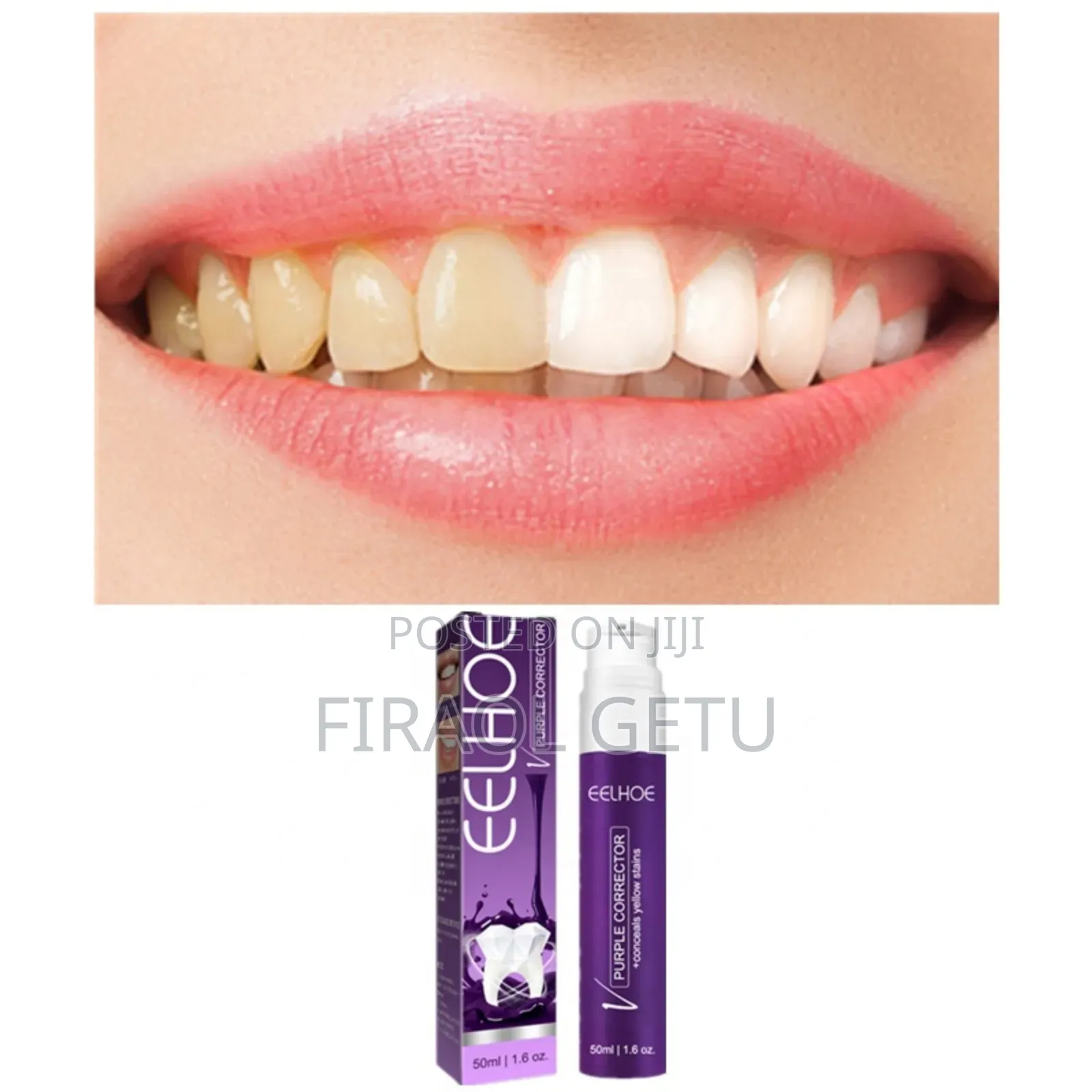 Eelhoe Purple Corrector for Teeth
