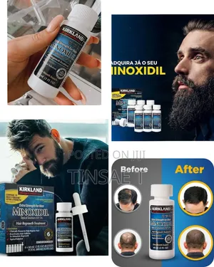 Photo - Orginal Kirkland Minoxidil