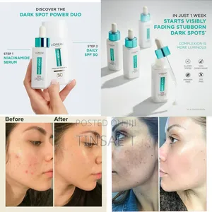 Photo - l'Oreal Serum for Fresh Looking Skin