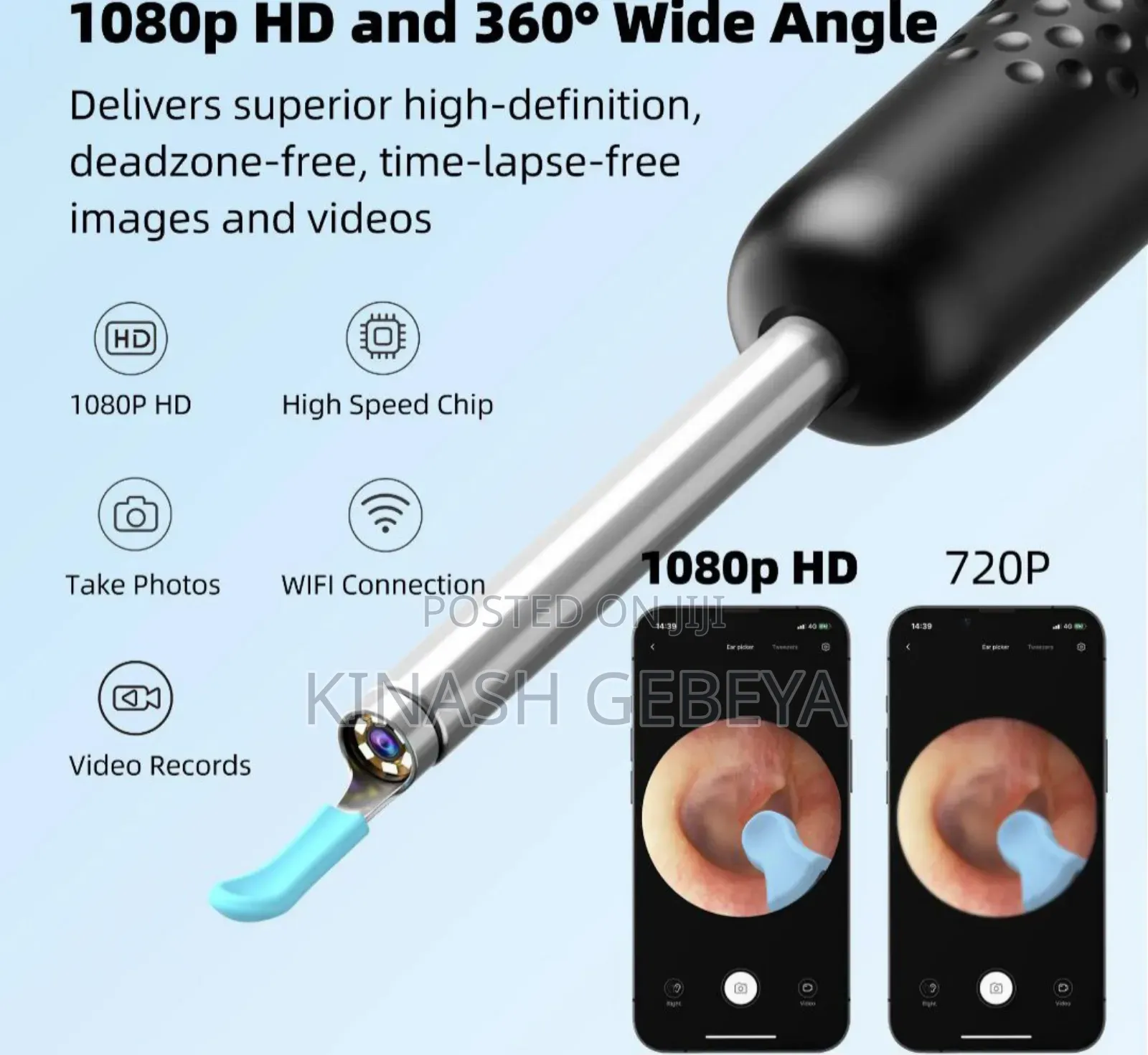 Xiaomi Smart Visual Ear Cleaner(ዘመናዊ የጆሮ ማፅጃ)