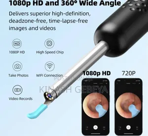 Photo - Xiaomi Smart Visual Ear Cleaner(ዘመናዊ የጆሮ ማፅጃ)