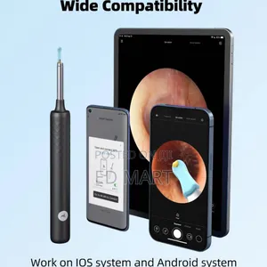 Photo - Xiaomi Bebird Smart Visual Earcleaner