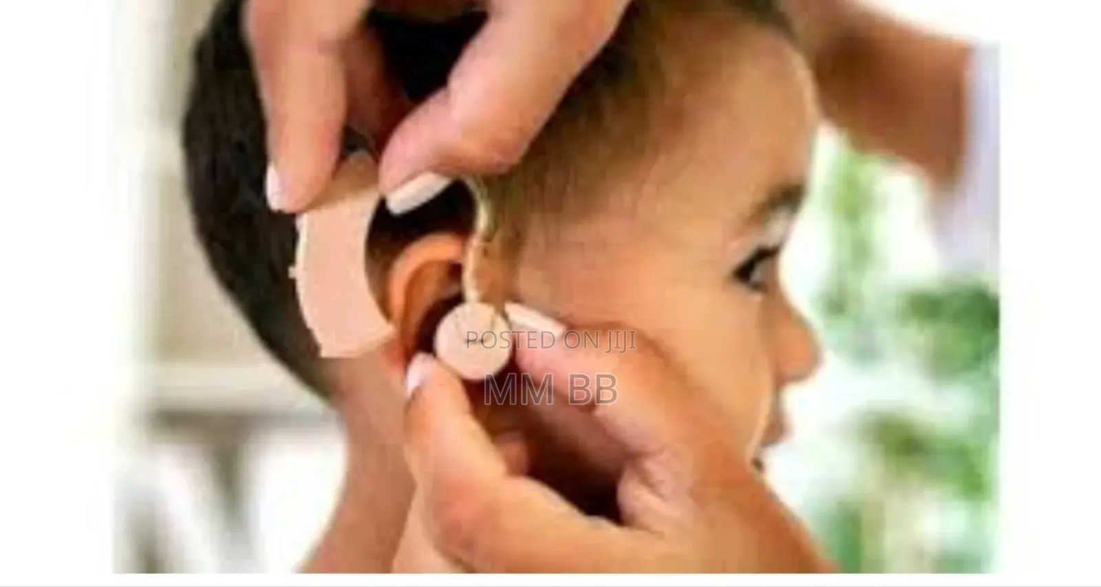 የማዳመጫ መርጃ መሳሪያ