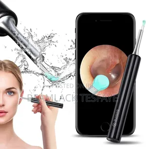 Photo - Xiaomi Original Bebird R1 Visual Ear Wax Cleaner