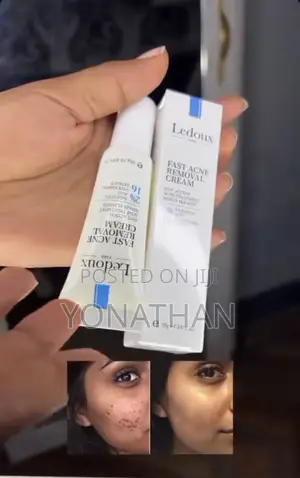 Photo - Ledoux Fast Acne Removal