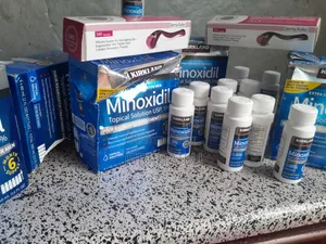 Photo - Minoxidil ፀጉር ማሳደግያ