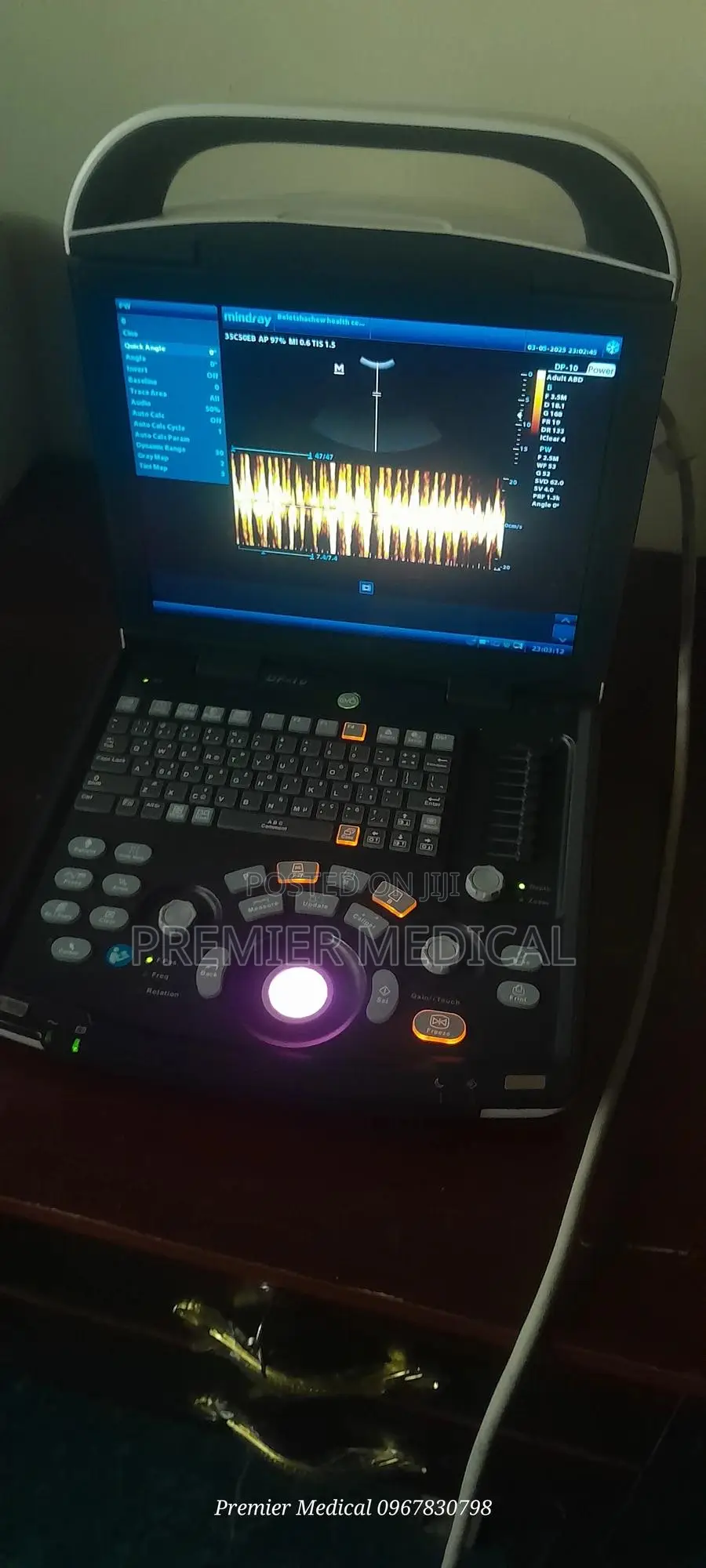 Mindray Dp 10 Ultrasound