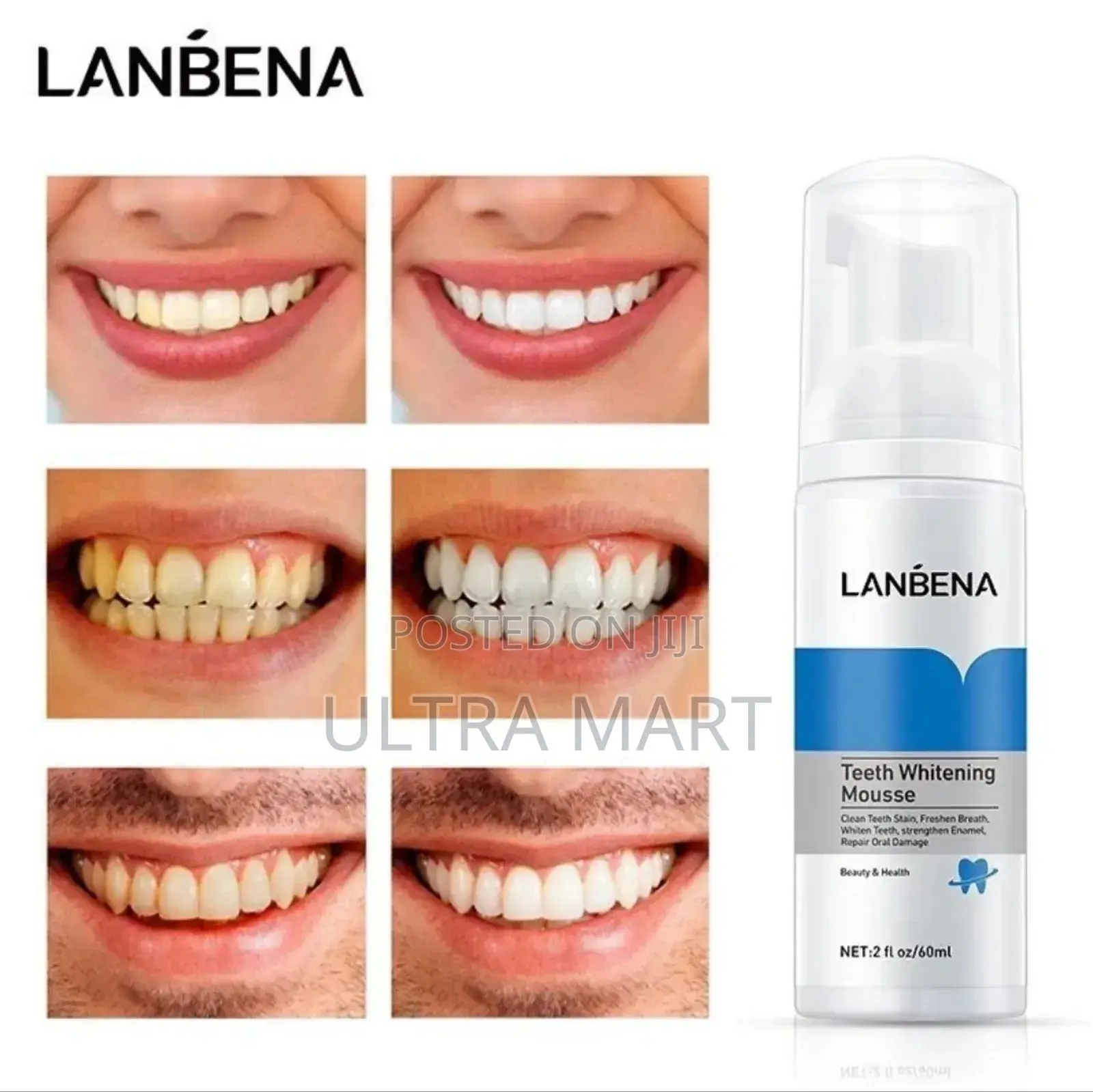 Lanbena Teeth Whitening