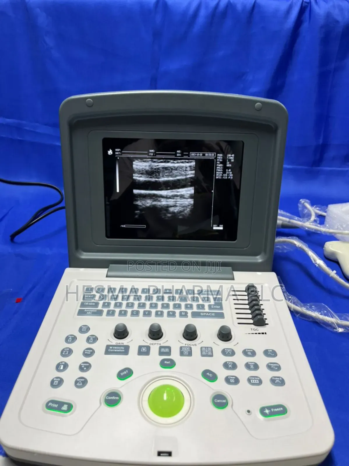 New Ultrasound Machine